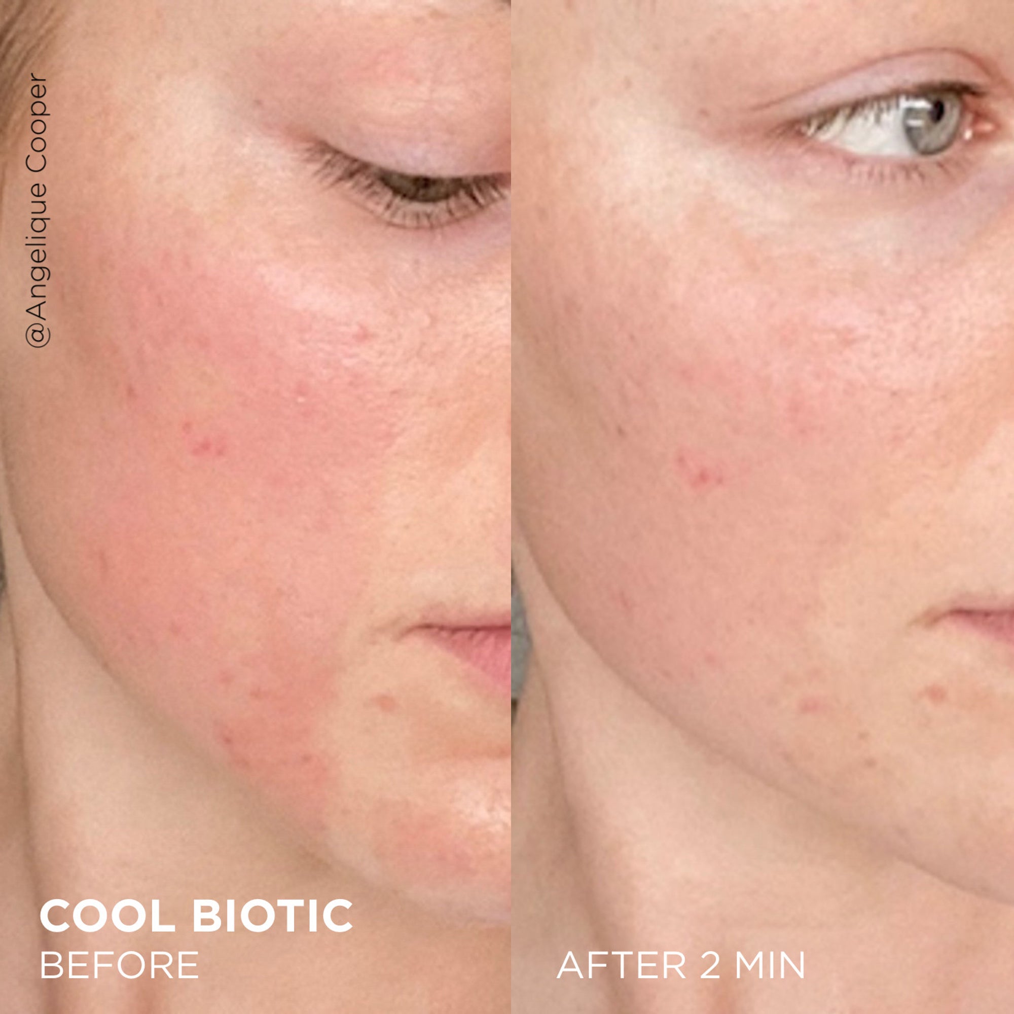 Cool Biotic Prebiotic Redness Relief Cream